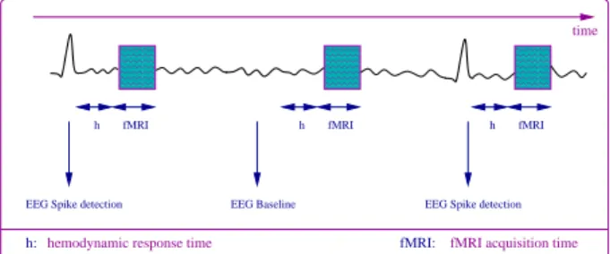 Fig. 1. The EEG signals are continuously observed. Some fMRI volumes acquisitions are triggered when a spike of epileptic activity is detected while some “baselines” are triggered in the absence of epileptic activity.