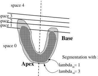 Fig. 6. Splitting the image volume by planes normal to the heart long axis.