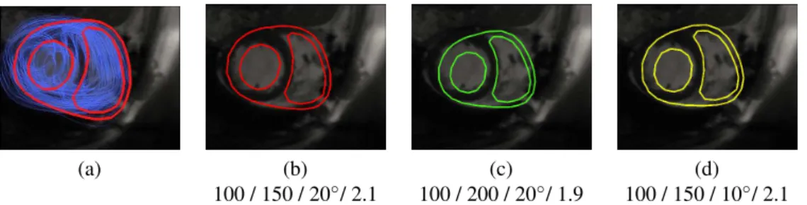 Figure 2. Parameter sweep on initialization parameters. (a) 75 parameter have been tested ; (b),(c) and (d) initialization results kept for segmentation