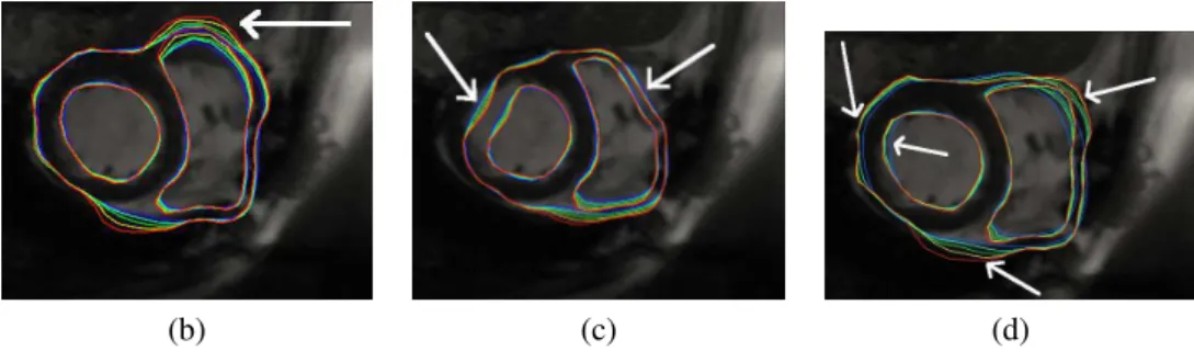 Figure 3. Parameter sweep on segmentation parameters. Five force factors have been tested for each initial- initial-ization, as denoted by the color scale (blue: 0.1 ; cyan: 0.2 ; green: 0.3 ; yellow: 0.4 ; red: 0.5)
