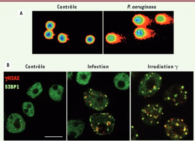 Figure 1. P. aeruginosa casse l’ADN des cellules infectées. A. Test Comet. Les cellules sont dépo- dépo-sées dans un gel fin d’agarose, puis leur ADN est soumis à un champ électrique