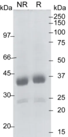 Figure 2. SDS-PAGE analysis of the recombinant MASP-3 SP domain. The purified SP domain of MASP-3 was analyzed by SDS-PAGE under non-reducing (NR) and reducing (R) conditions followed by Coomassie blue staining