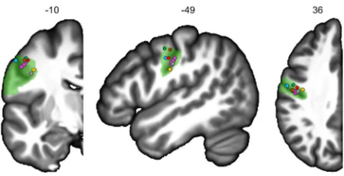 Fig. 5    Locations of the activation peaks from five studies on the left  hemisphere coronal, sagittal and axial slices from the BIL&amp;GIN  dis-play template; the hROI numbers correspond to the x, y and z-axes in  the MNI space