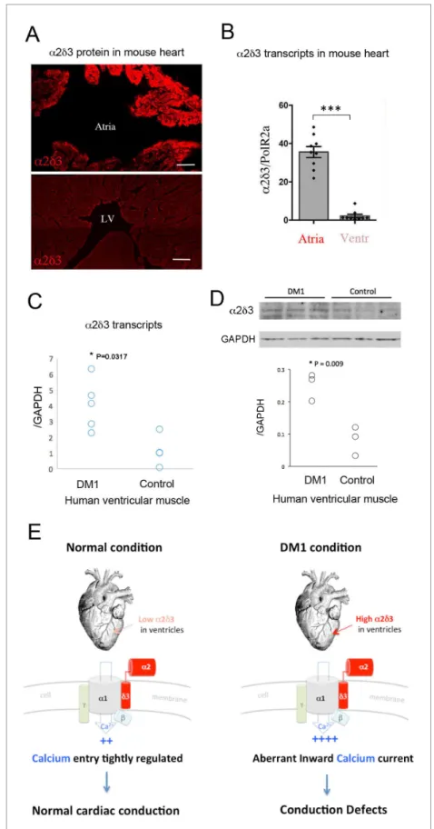 Figure 6. Increased cardiac expression of Straightjacket human ortholog a 2 d 3 is associated with conduction defects in DM1 patients