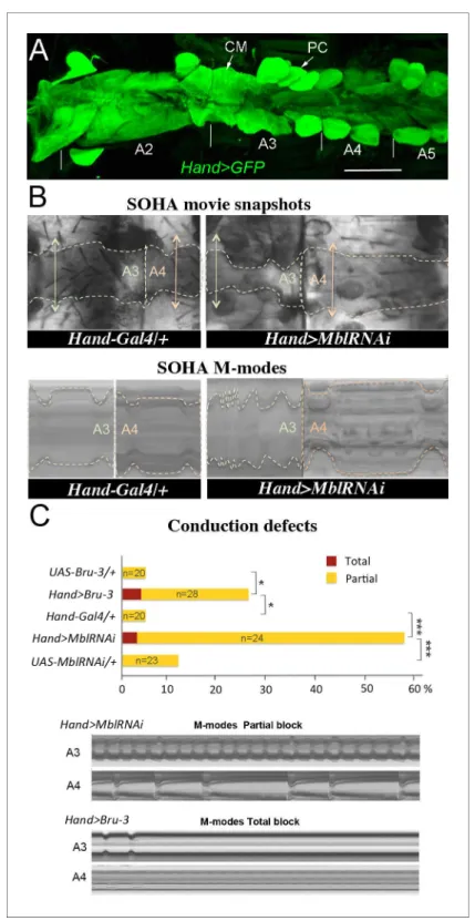 Figure 1. Cardiac-specific knockdown of MBNL1 ortholog and overexpression of CELF1 counterpart in Drosophila lead to asynchronous heartbeats