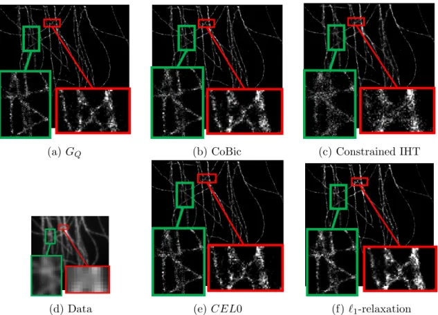 Figure 6: Reconstructed images from the Real ISBI dataset. Top: From left to right: