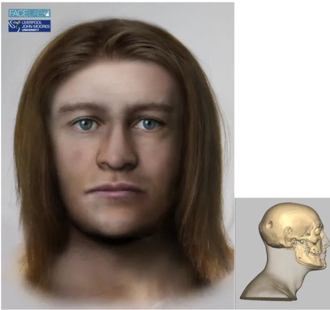 Fig 6. The left picture shows the facial depiction of SK259 while the right picture shows the profile view of the textured skull of the same man.