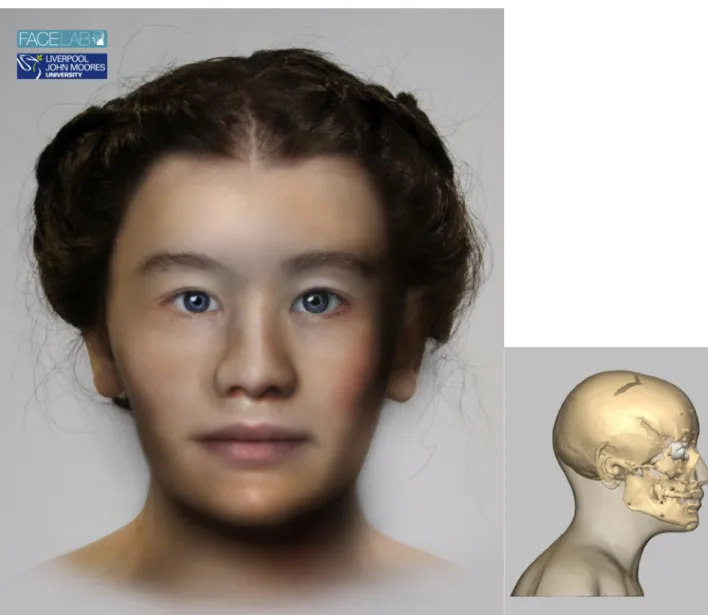 Fig 1. The left picture shows the facial depiction of SK152 while the right picture shows the profile view of the textured skull of the same woman.