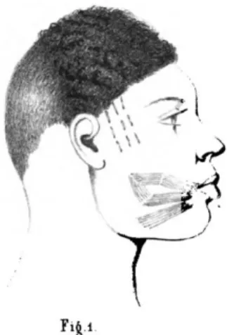 Figure 2 – Portrait de Manuel ou Mahammah « haoussa : à la bouche la  marque des haoussa de Kano ; sur les tempes celle d’Absen, d’où venait sa 