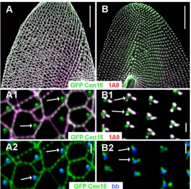 Fig. 2. Wild-type and ICL-less (BP) cells: respective localisations of ICL1e, ICL centrins and basal bodies