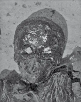 Fig. 2 : Momie de petit garçon âgé de cinq/sept ans présentant des traces  de dorure corporelle au niveau du visage