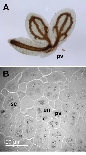 Figure 4: Fe distribution in Arabidopsis thaliana mature embryo. A. Perls DAB staining of Fe  in the whole embryo shows high concentration of Fe (brown color) around the 