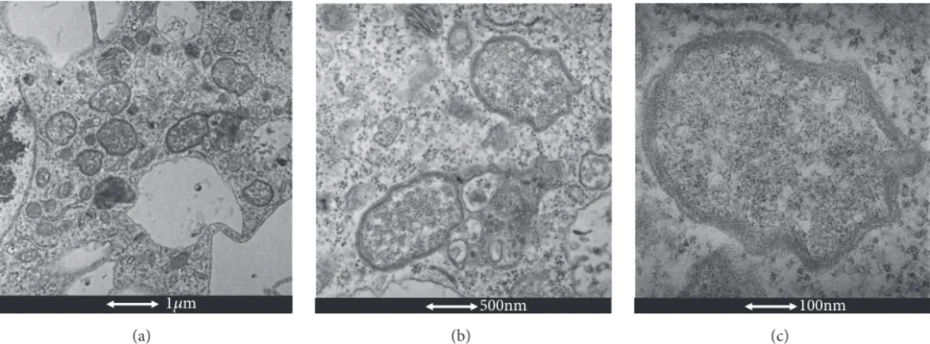 Figure 1: Electron microscopy of Wolbachia. (a) Wolbachia cocci (Scale bar: 1 