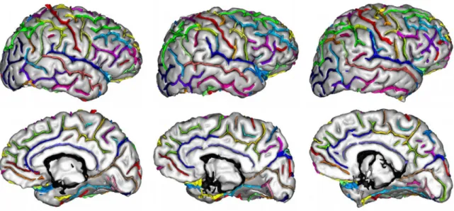 Fig.  1. Illustration of cortical folds variability.  The  manual labeling  of  the  three right  hemispheres  represented  here  shows the  variability  of  cortical sulci  by  their  shape,  size,  and position