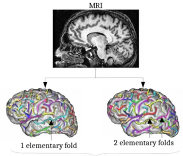 Fig. 5. A computer vision pipeline mimicking a human anatomist (  Mangin et al.,  2015  )