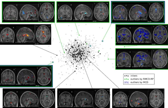 Figure 7: Neuroimaging data projection on the space spanned by the two principal components of the full, cleaned dataset