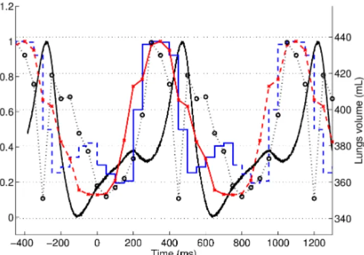 Fig. 1. Image-based motion signal from 4D-SPECT and 4D- 4D-CT image compared to the pressure signal and lung volume variation.