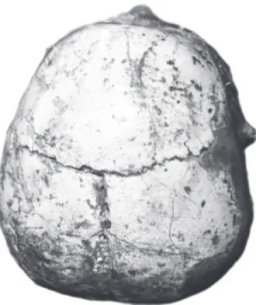 Fig. 3 – Vue supérieure du crâne surmodelé D117 de Jéricho  (photographie F. Bocquentin, avec l’aimable autorisation du Musée  Nicholson de l’Université de Sydney ; n° de pièce : NM57.3).