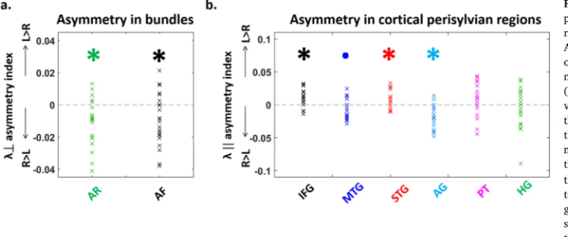 Fig.  4. Hemispheric  differences  in  the  DTI  properties  of  white  matter  tracts  and  cortical  regions