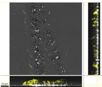 Fig. 5. Scratch observed in reflection (black and white scale) and ELSM mode with Lucifer  Yellow tagging (yellow scale)