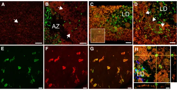 Figure 1. Subretinal MPs accumulate on the retinal pigment epithelium in AMD.