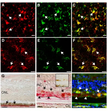 Figure 2. Subretinal MPs express APOE.