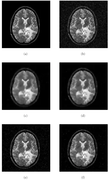 Figure 11: Filtering results for Laplacian noise: (a) original image, (b) noisy image, (c) Huber, (d) entropic, (e) total variation, and (f) improved entropic.