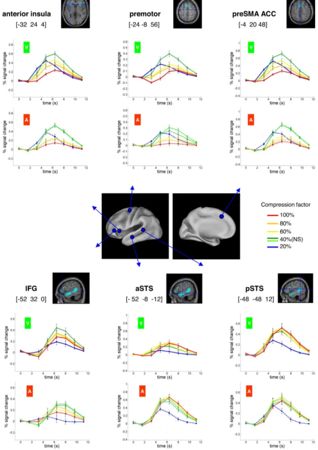 Figure 4. Time course of fMRI responses in regions exhibiting a nonlinear profile of activation as function of stimulus duration