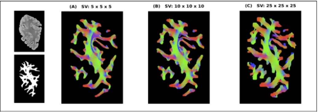 Figure 1: Panels A-B-C show the streamlines passing through the central coronal slice of the studied dataset with the usual orientation-based colouring