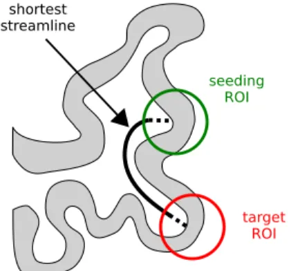 Figure 3: Sample spherical ROIs surrounding two endpoints — a stimulation site (seeding ROI) and an ECoG electrode location (target ROI)