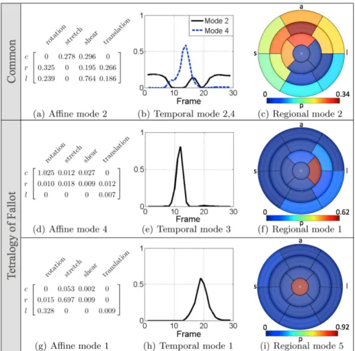 Fig. 2. Dominant mode combinations common to both cohorts: affine mode 2 (a), temporal modes 2 and 4 (b), and regional mode 2 (c)