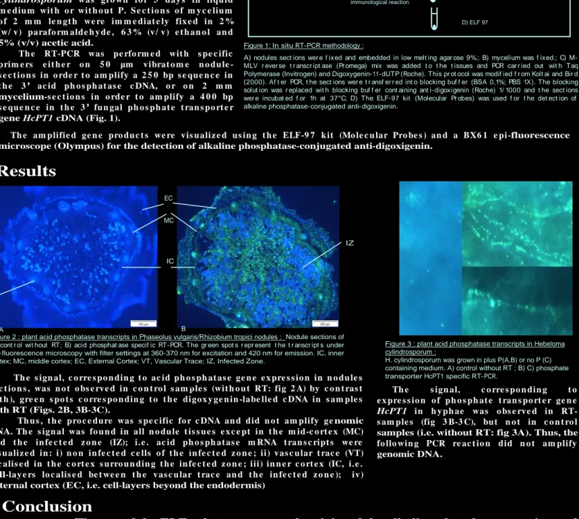 Figure 3 : plant acid phosphatase transcripts in Hebeloma  cylindrosporum :