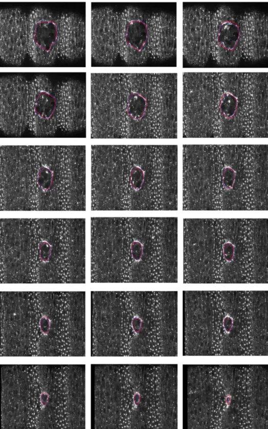 Figure 3: Wound images at successive times with extracted (blue) and simulated (red) contours