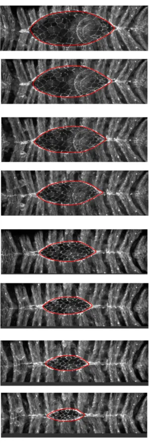 Figure 6: Dorsal Closure images at successive times with simulated contours (in