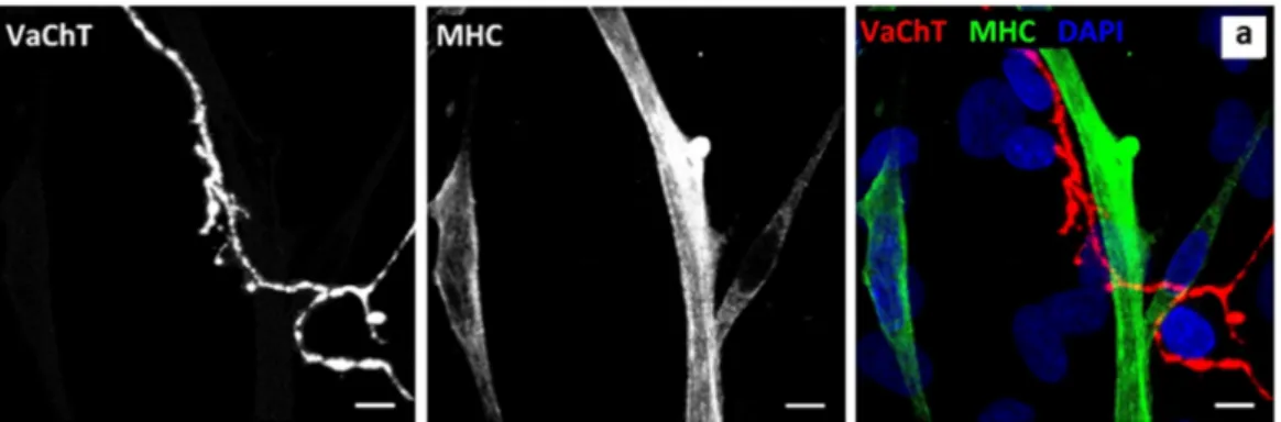 Figure 2. Cholinergic motor neurons co-localise with myotubes at Day 14. Panel a is a representative  image of co-culture stained for vesicular acetylcholine transporter (VaChT) (red), myosin heavy chain  (MHC) (green) and DAPI (blue)