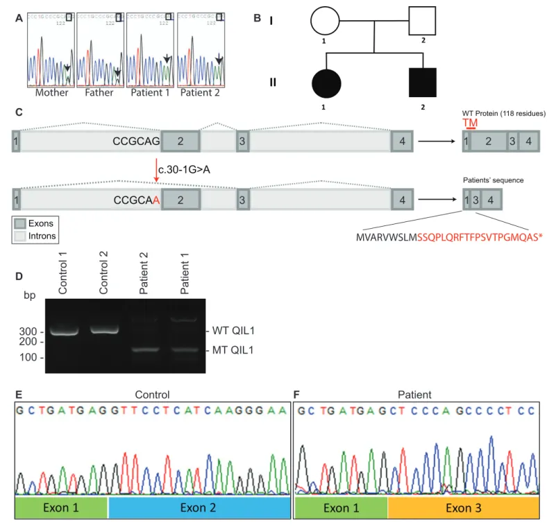 Figure 2. Identification of mutations in QIL1. (A) Chromatogram depicting a homozygous mutation (c.30-1G&gt;A) in C19orf70 (QIL1)