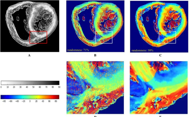 Fig. 4. Inclination angle maps of a coronal ventricular slice: (A) Absolute inclination