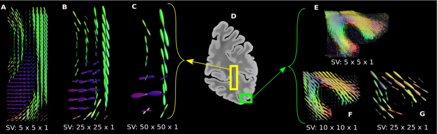 Fig. 3. Fiber ODFs computed from a coronal slice of the brain’s right hemisphere.
