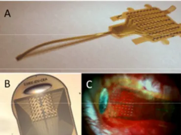 Figure  3  :  (A):  view  of  a  non-3D  diamond  MEA  implant  for  retinal  stimulation