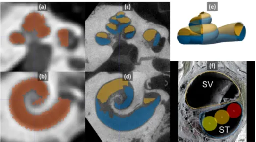 Fig. 1: Slices of CT (a,b) and µCT (c,d) with segmented cochlea (red), ST (blue) and SV (yellow)