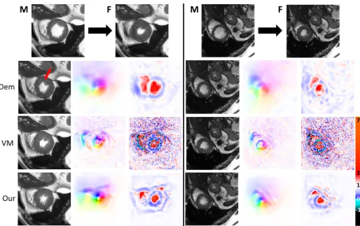 Fig. 3: Two random examples of end-diastole to end-systole registration: (Row 1) orig- orig-inal images