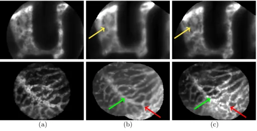 Fig. 1. (a) frame from a pCLE sequence; (b) static mosaic reconstructed by averaging;