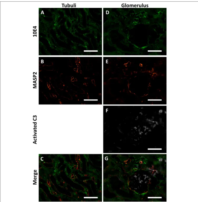 FIGURE 6 | MASP2 is bound to HSPGs in an enzymatically inactive state. (A–C) Confocal immunofluorescence double staining of HS marker 10E4 (green) showed partial co localization with MASP-2 (red) in some tubular and vascular basement membranes of human don