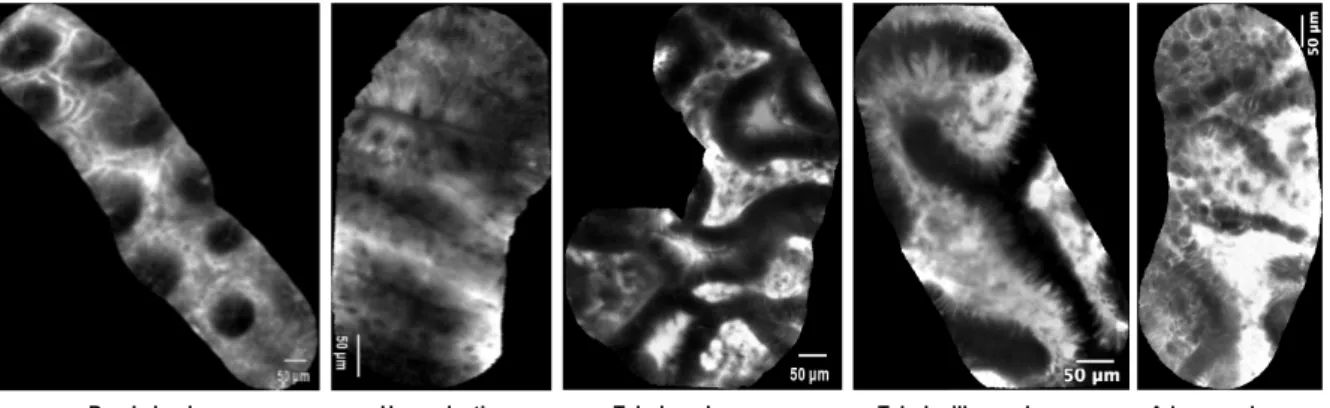 Figure 2: Examples of annotated endomicroscopic videos.