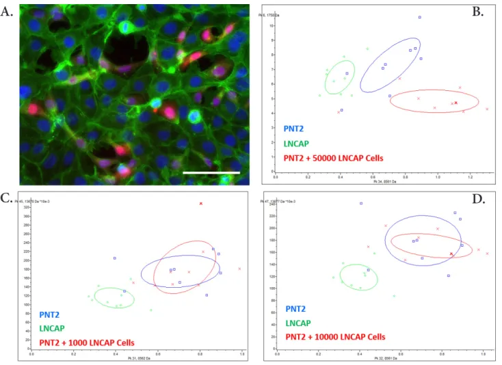 Figure 6. PNT2 cells co-cultured with LNCaP cells. A. Mixed population of non-cancerous (PNT2) and cancerous (LNCaP) prostatic  cells