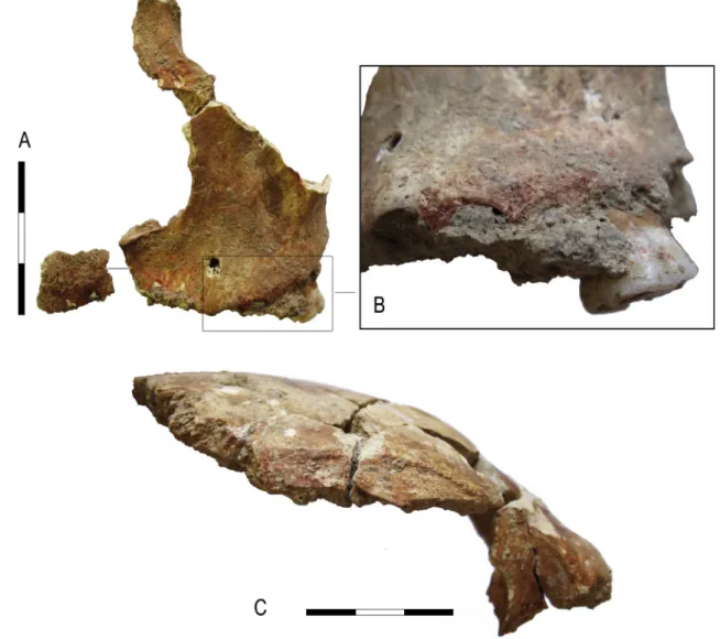 Fig. 6. A- Left maxilla of cranium 108 (anterior view). Note the red pigment preserved on the piece of breccia which was in contact with the anterior part of the alveolar process