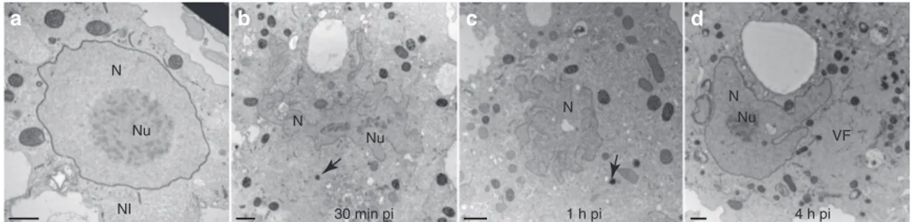 Figure 9 | Ultrathin-section TEM images of nuclei of A. castellanii cells undergoing a Noumeavirus infection