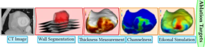 Fig. 1. Our Modelling Pipeline. After image acquisition, the en- en-docardial mask is segmented using a region-growing algorithm; the epicardial mask using manually drawn splines on a few slices and interpolation in-between