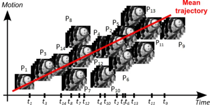 Fig. 2: Linear cross-sectional analysis is applied to motion transformations to regress the motion of a set of patients at different stages in the progression of the disease.