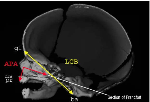Figure 2: scanner of a male fetus of 37 weeks of amenorrhea: sagittal section. 